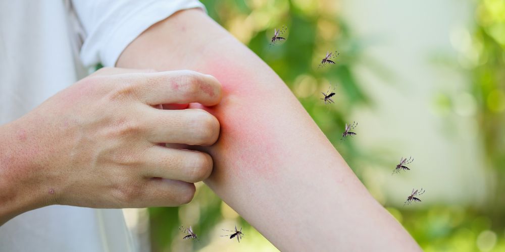 Lee más sobre el artículo UGT critica que profesionales y usuarios del Centro de Salud de Nájera sufren picaduras de insectos y malos olores en el vestidor de la sala de rayos